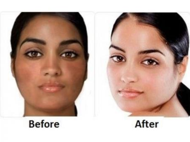 Best skin lightening,whitening and bleaching products +27787700984